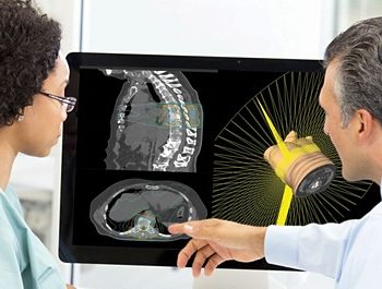 Pinnacle³ IMRT/VMAT/SmartArc