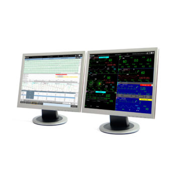 Philips IntelliVue Information Center iX — центральная станция мониторинга