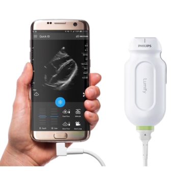 Philips Lumify — ультрапортативная ультразвуковая система