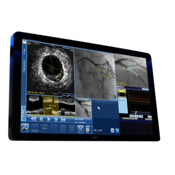 SyncVision — система для выполнения высокоточной терапии