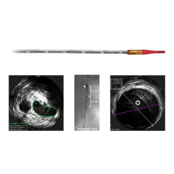 Visions PV (0,035 дюйма) — цифровой катетер для ВСУЗИ