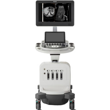 Philips Affiniti 50 — ультразвуковая система высокого класса