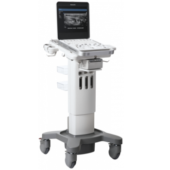 Philips CX50 — портативная УЗ система экспертного класса